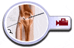 Knee Arthroscopy, Pocatello Idaho