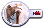 Shoulder Arthroscopy, Pocatello Idaho